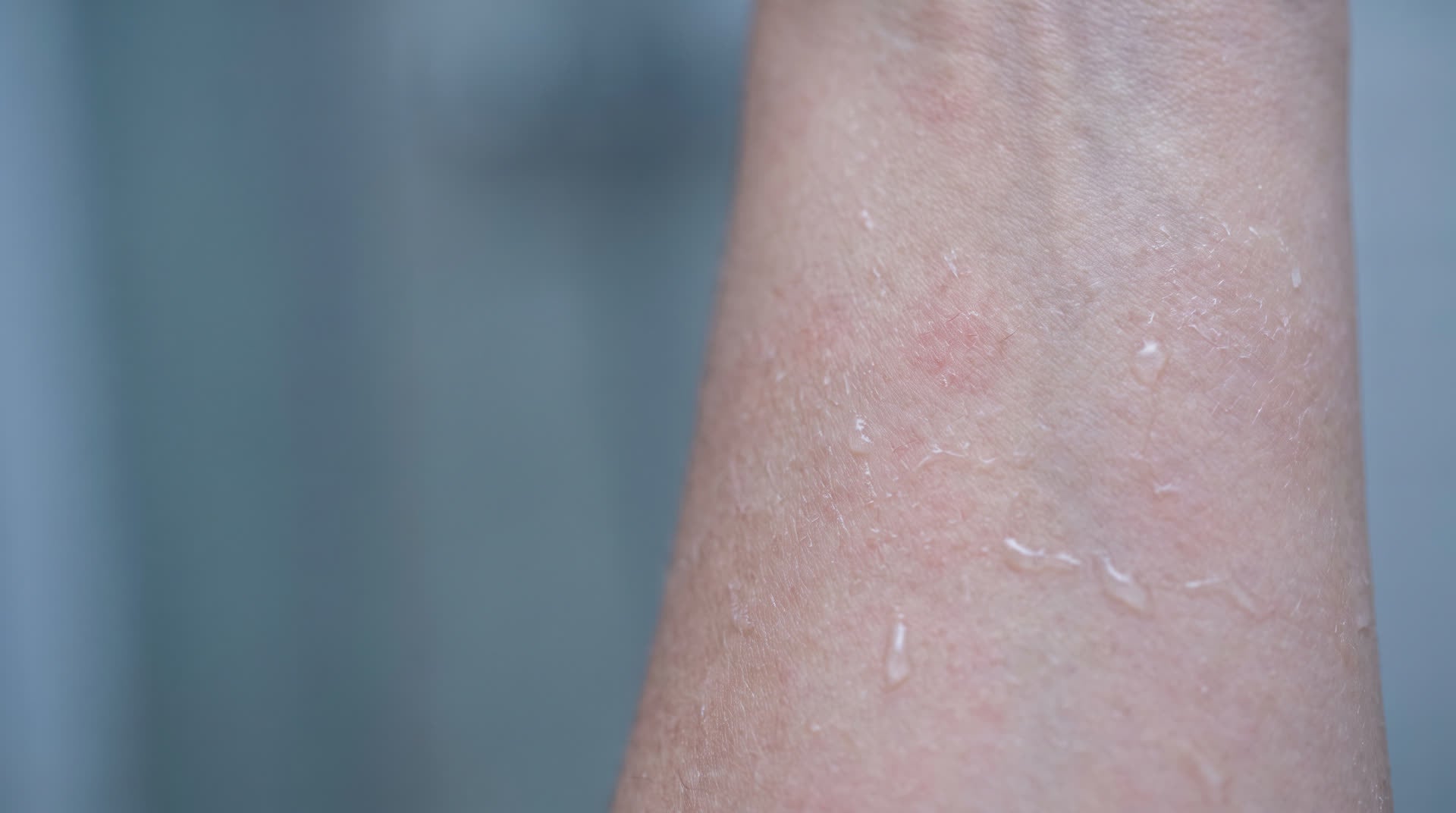 Dry, irritated skin close-up
